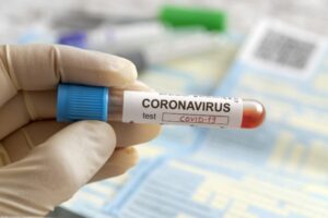 A corona virus test tube.